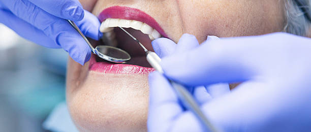 Best Pediatric Emergency Dentist in Cedaredge, CO